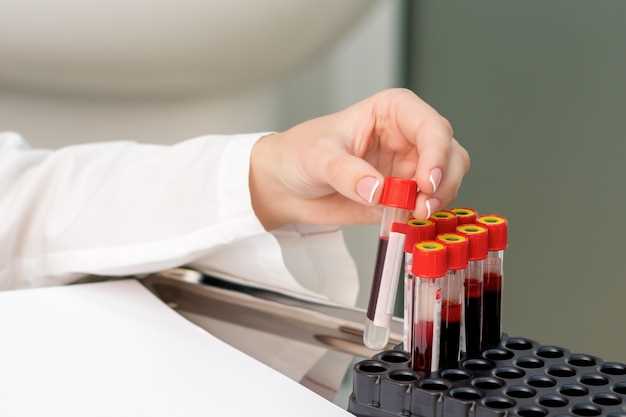 Необходимость биохимического анализа крови перед клиническим