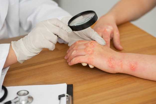 Эффективные методы лечения поражения кожным клещом на лице