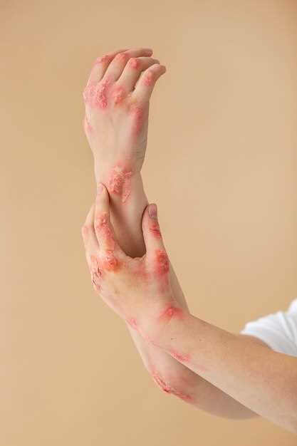 Травмы и ушибы – причины лопанья сосудов на руках и появления синяков